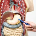 Laparoscopic Gastric Bypass 150x150