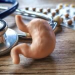 Laparoscopic Mini Gastric Bypass 150x150