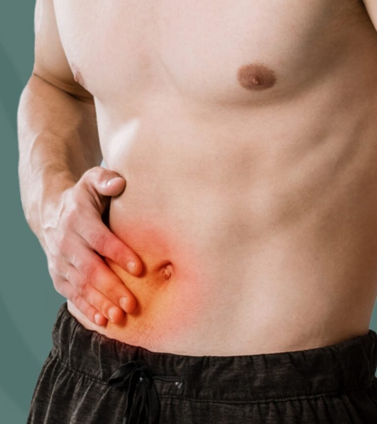 hernias