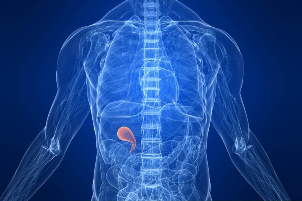 Cholecystectomy (Gallbladder) Cholecystectomy (Gallbladder)